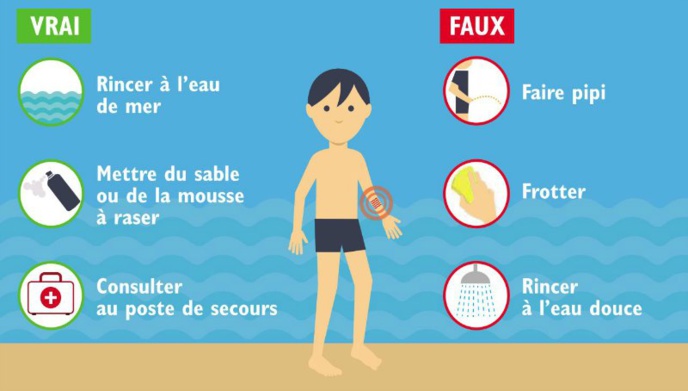 Soigner les piqûres de méduses